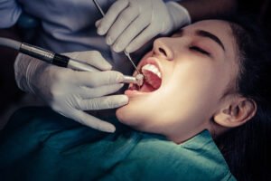 Read more about the article How Much Does Teeth Cleaning Cost in Bangalore? A Complete Guide
