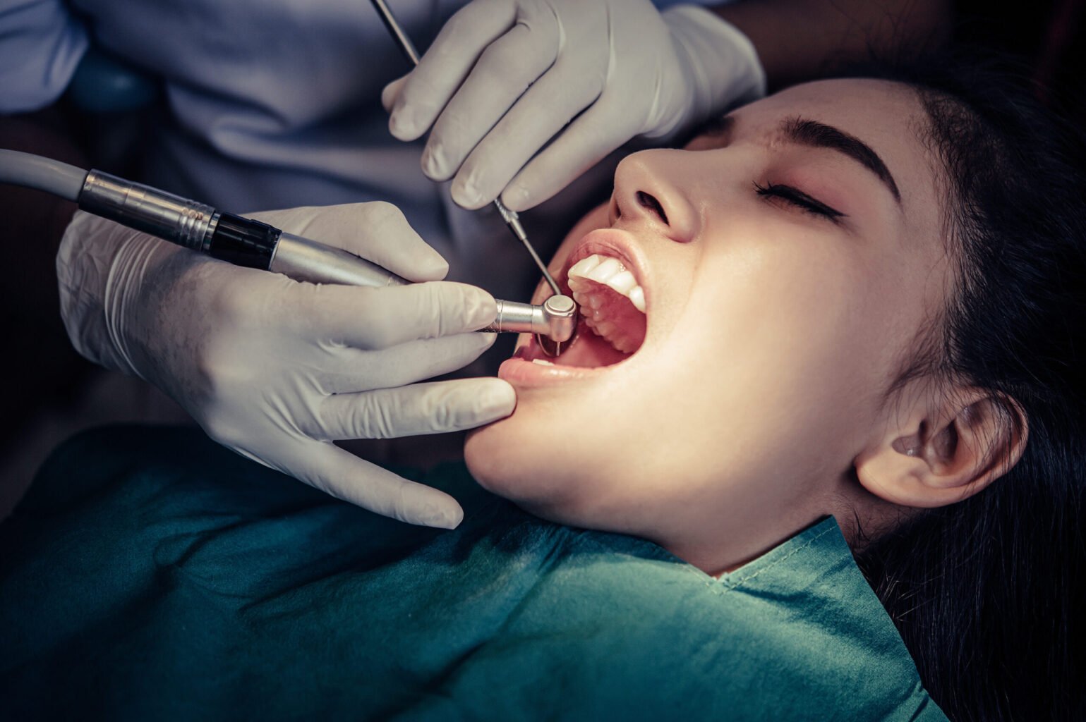 Read more about the article How Much Does Teeth Cleaning Cost in Bangalore? A Complete Guide