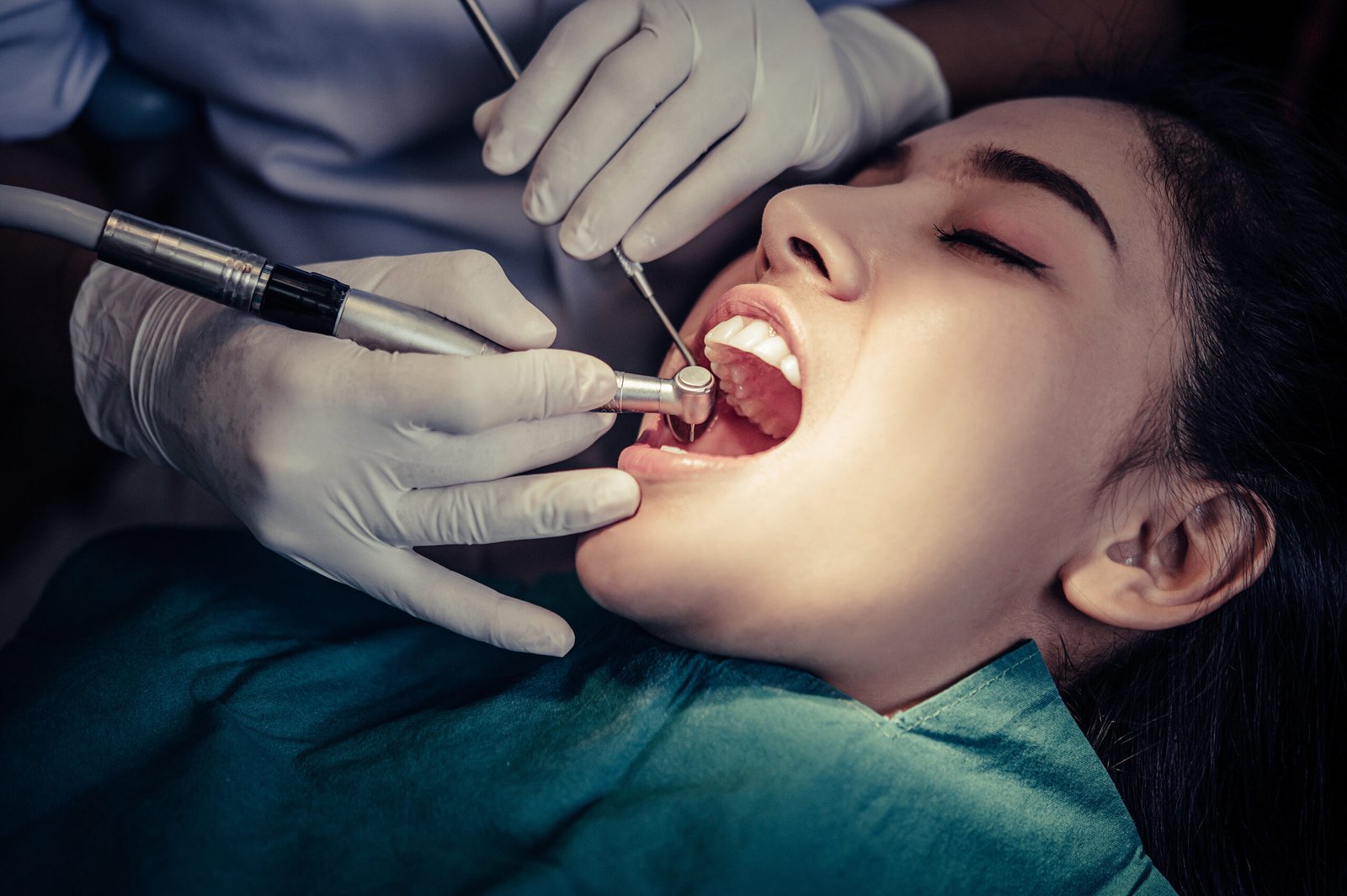 Read more about the article How Much Does Teeth Cleaning Cost in Bangalore? A Complete Guide
