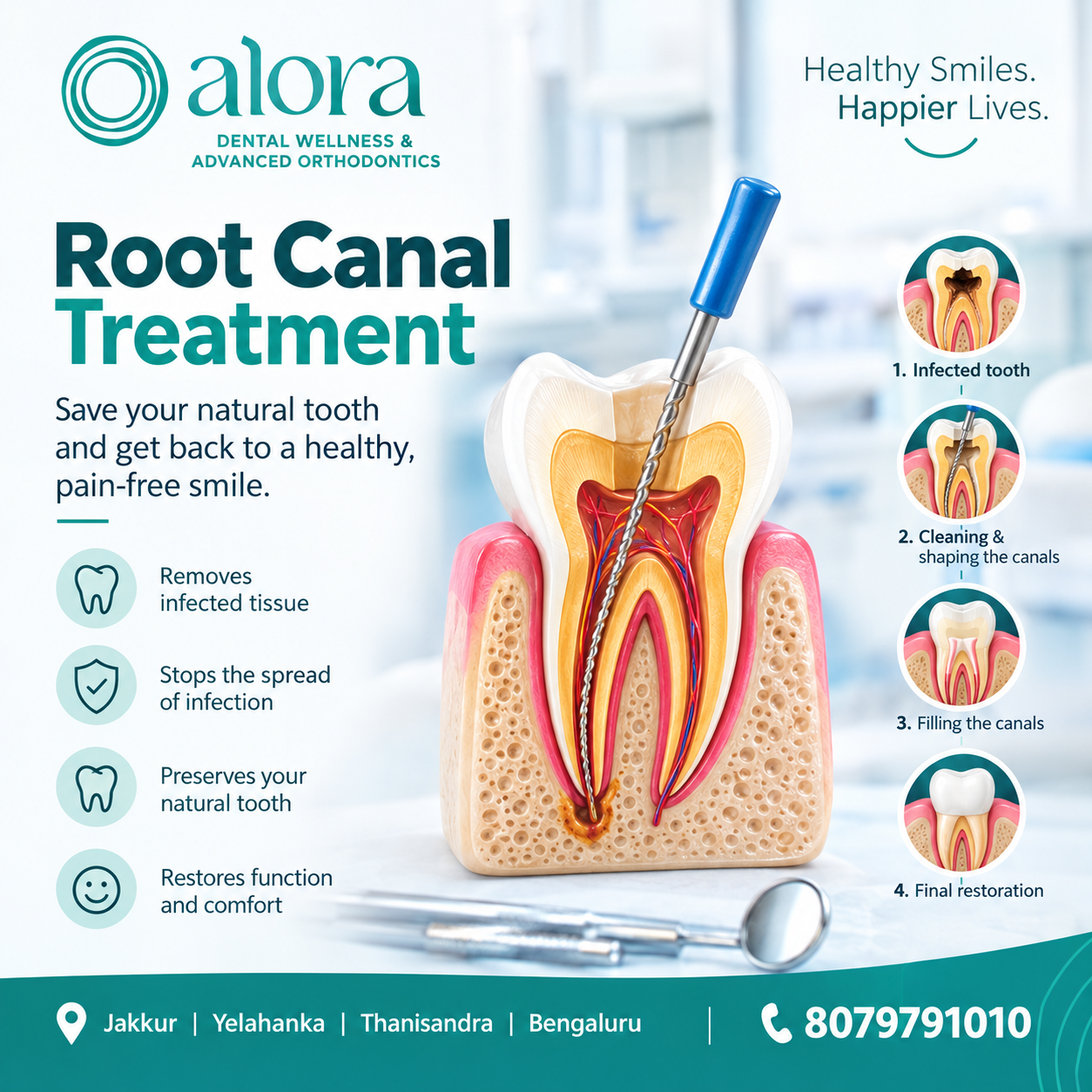 Read more about the article Root Canal Treatment: Your Complete Guide to Procedure, Recovery & Tooth Care